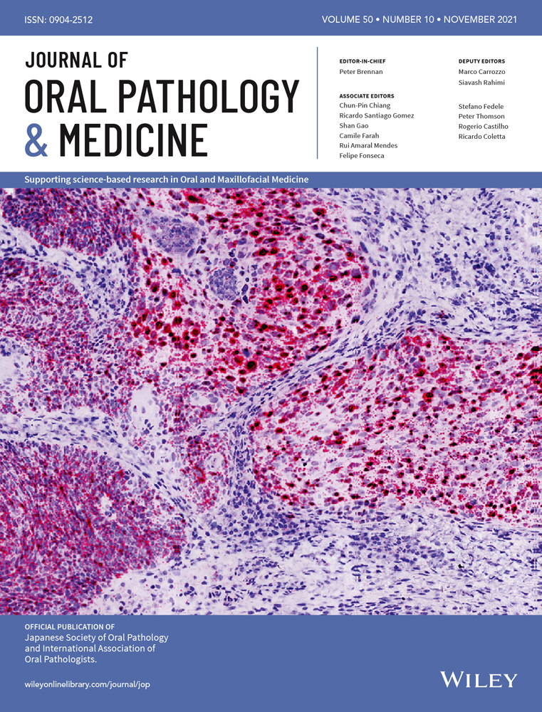 Bone marrow metastasis/carcinomatosis in head and neck squamous cell carcinoma