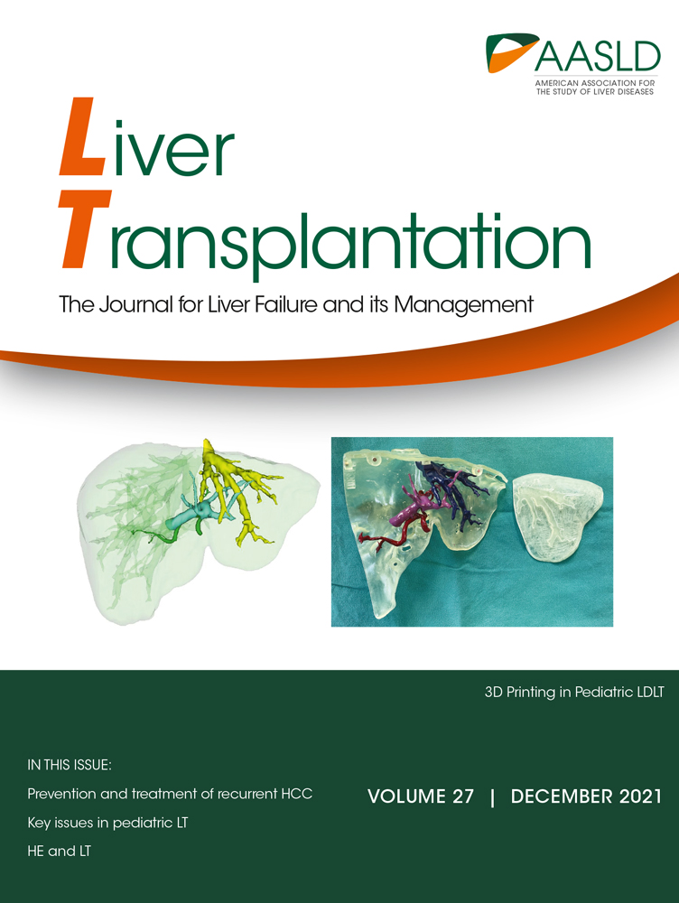 The Impact of Median Model for End‐Stage Liver Disease at Transplant Minus 3 National Policy on Waitlist Outcomes in Patients With and Without Hepatocellular Carcinoma