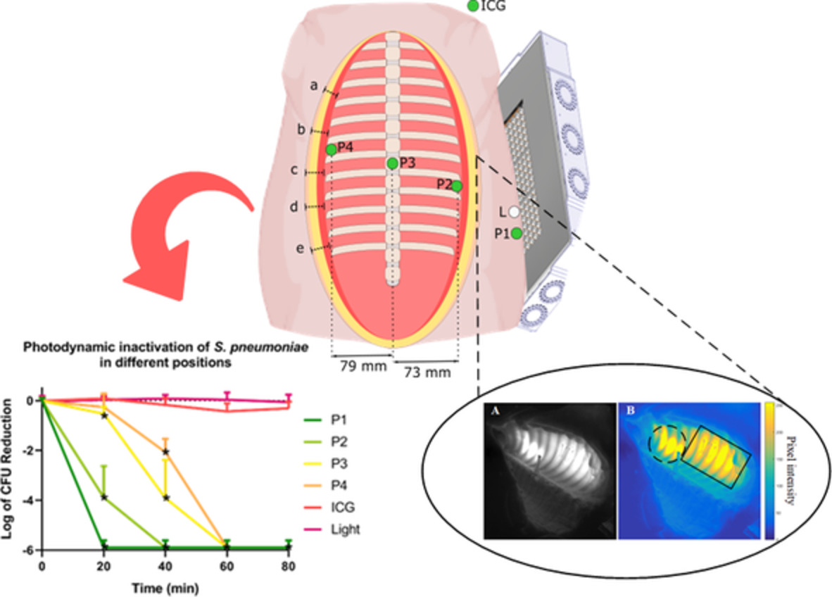 Photodynamic inactivation of Streptococcus pneumoniae with external illumination at 808 nm through the ex vivo porcine thoracic cage