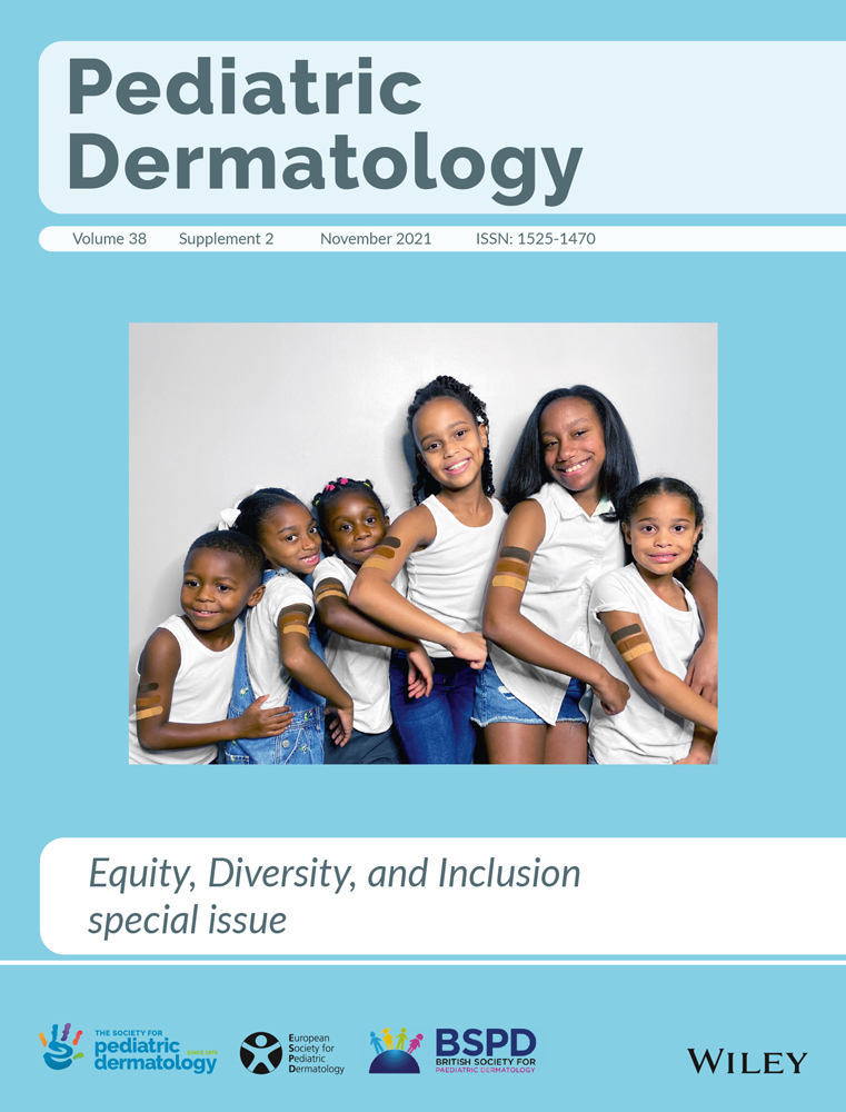 Cutaneous hyperpigmentation following bleomycin sclerotherapy for vascular malformations
