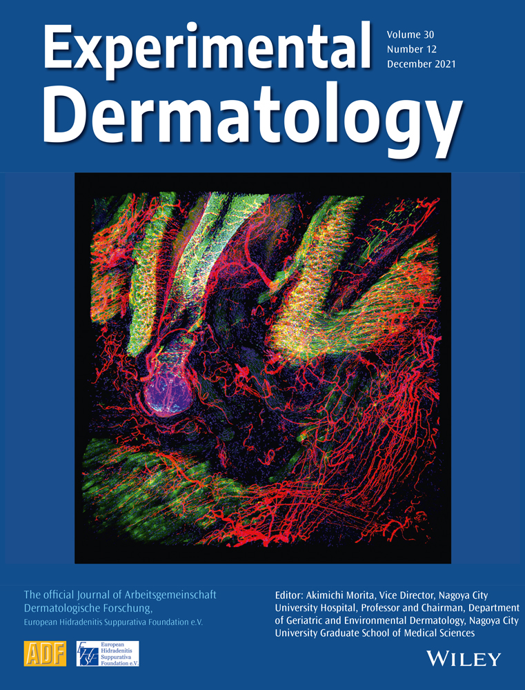 Concomitant Variants in NF1, LZTR1, and GNAZ Genes Probably Contribute to the Aggressiveness of Plexiform Neurofibroma and Warrant Treatment with MEK Inhibitor