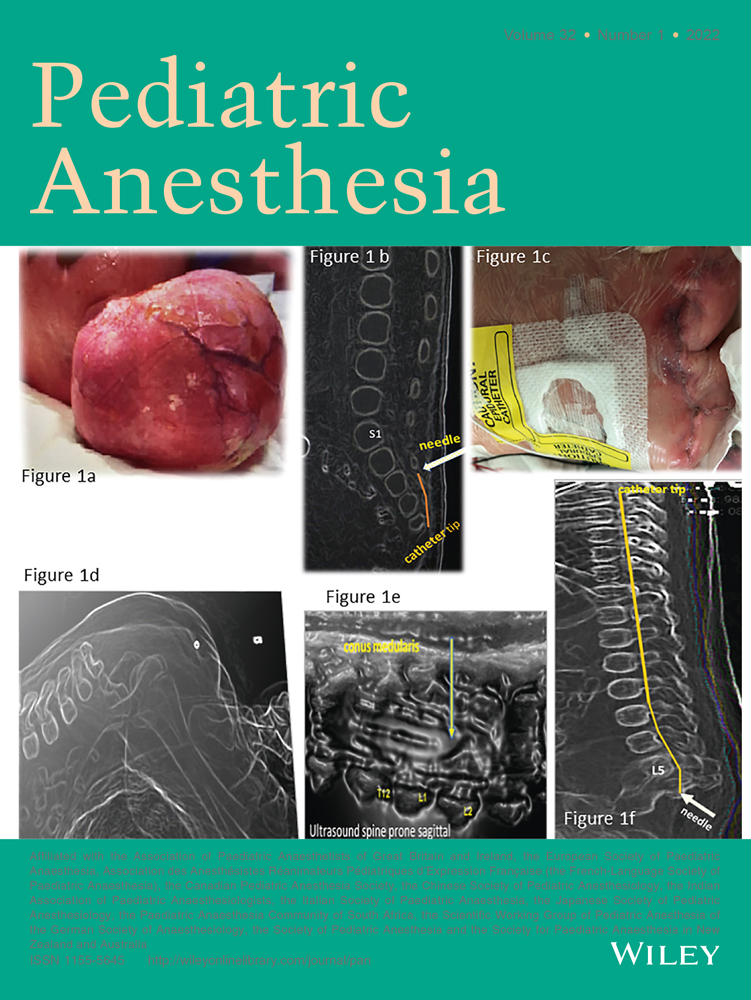 Update on ventilatory management of extremely preterm infants—A Neonatal Intensive Care Unit perspective
