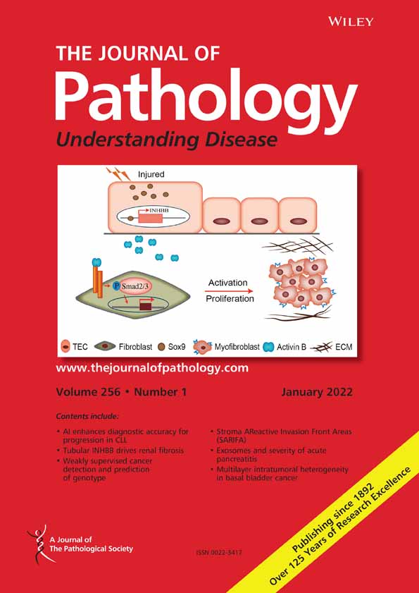 MyD88 in myofibroblasts regulates aerobic glycolysis‐driven hepatocarcinogenesis via ERK‐dependent PKM2 nuclear relocalization and activation