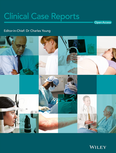 Challenges in corticosteroid dose regulation in a patient with autoimmune thyroid disease and neuropsychiatric syndrome: A running commentary