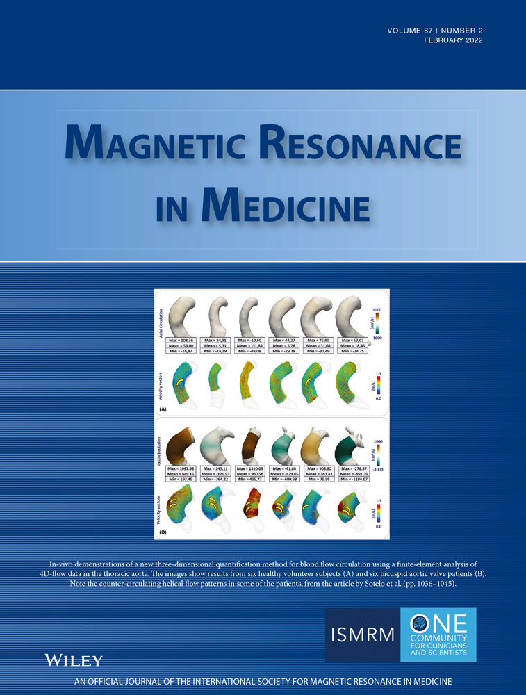Virtual injections using 4D flow MRI with displacement corrections and constrained probabilistic streamlines