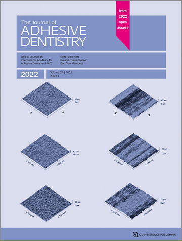 Effects of Hydrofluoric Acid Concentration and Etching Time on the Bond Strength ﻿to Ceramic-coated Zirconia