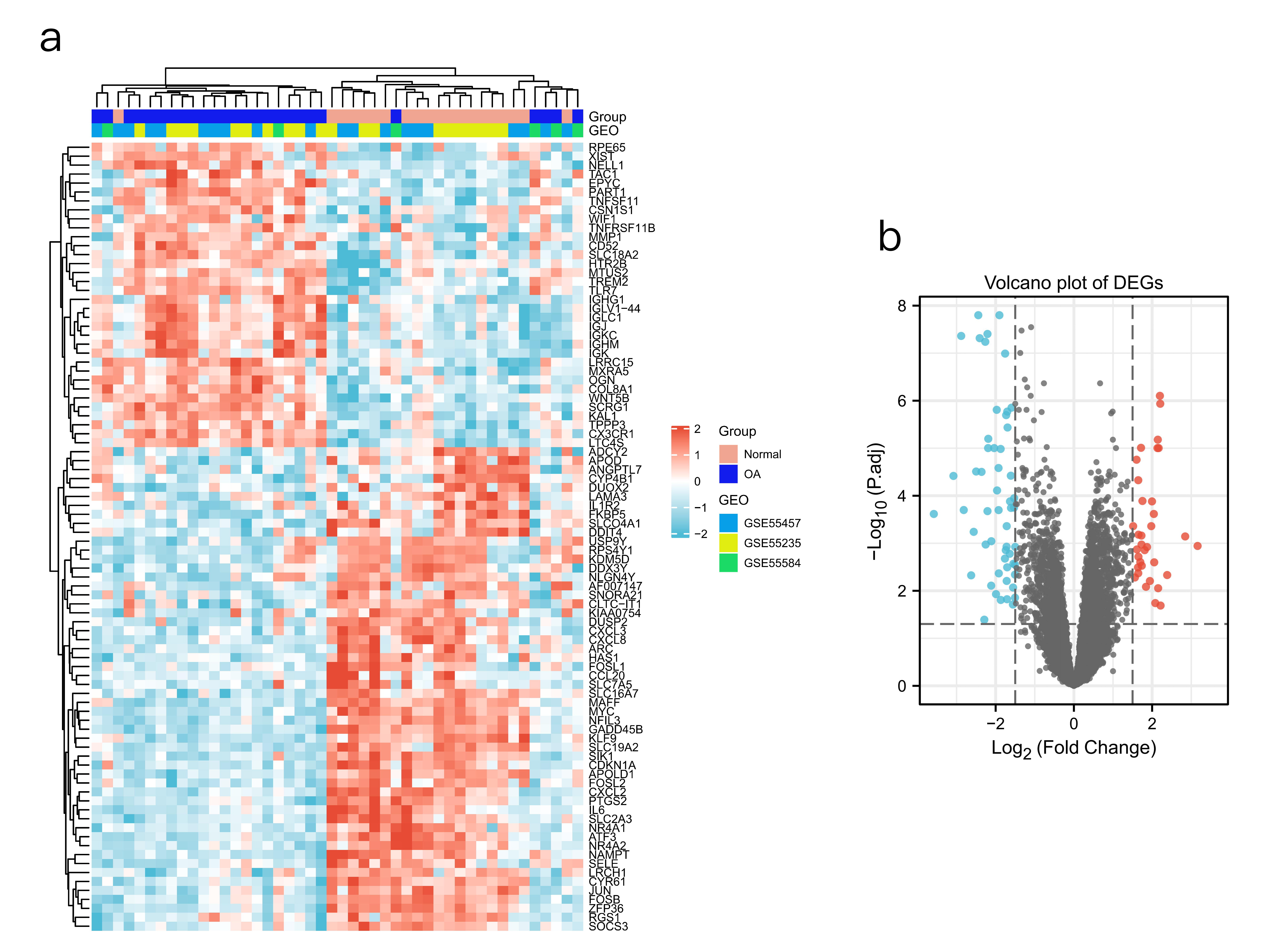 ATF3 as a potential diagnostic marker of early-stage osteoarthritis and its correlation with immune infiltration through bioinformatics analysis