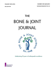 No need to add fusion to lumbar decompression for stenosis