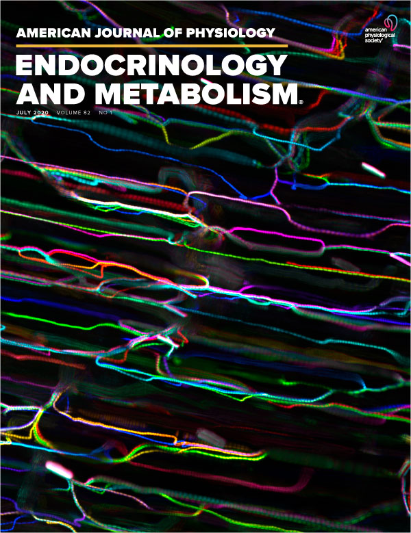 Untargeted Metabolomic Profiling Identifies Serum Metabolites Associated with Type 2 Diabetes in a Cross-Sectional Study of the ATBC Study