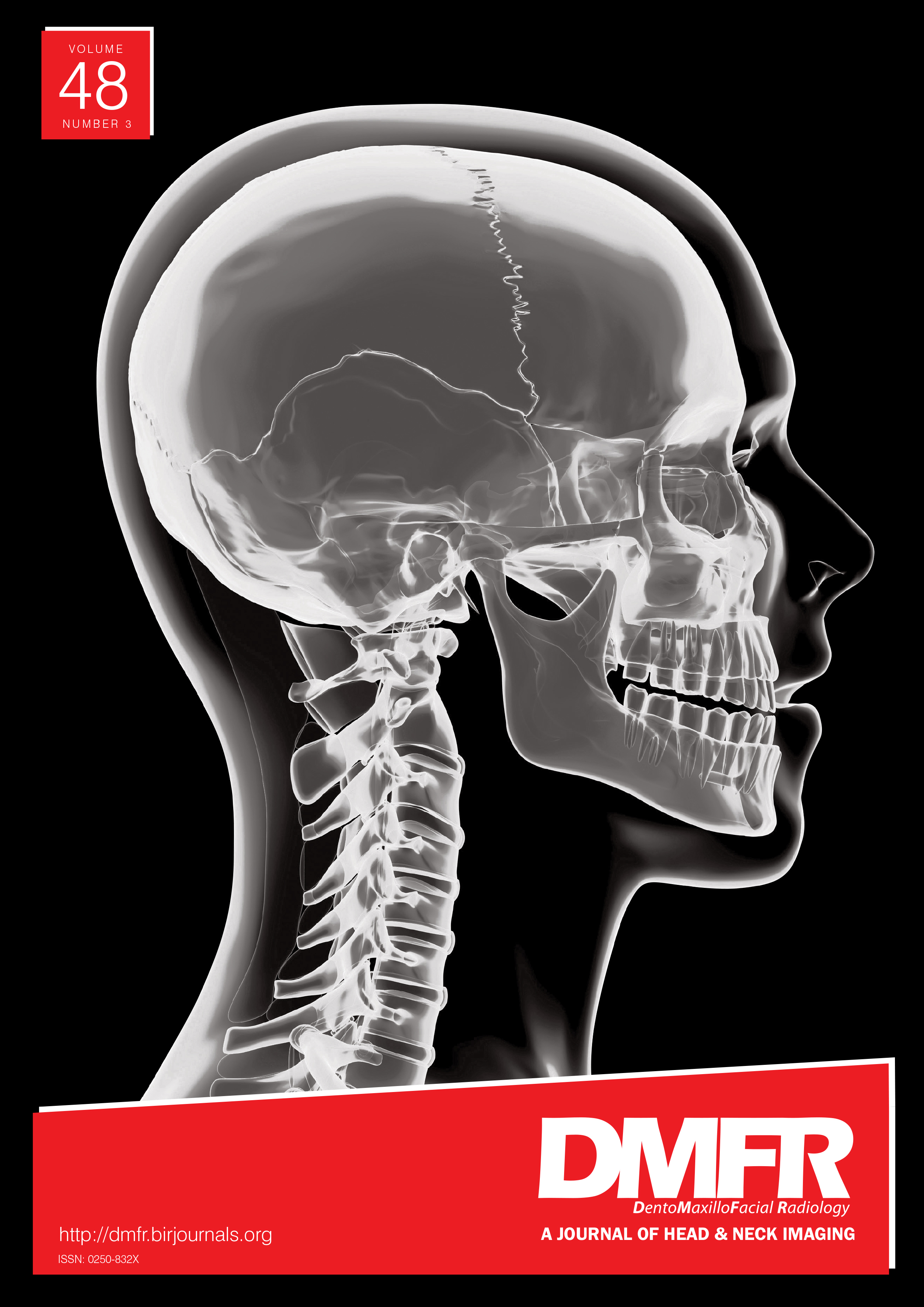 Prediction of accessory canals on the apical third of mandibular second molar based on micro-computed tomography