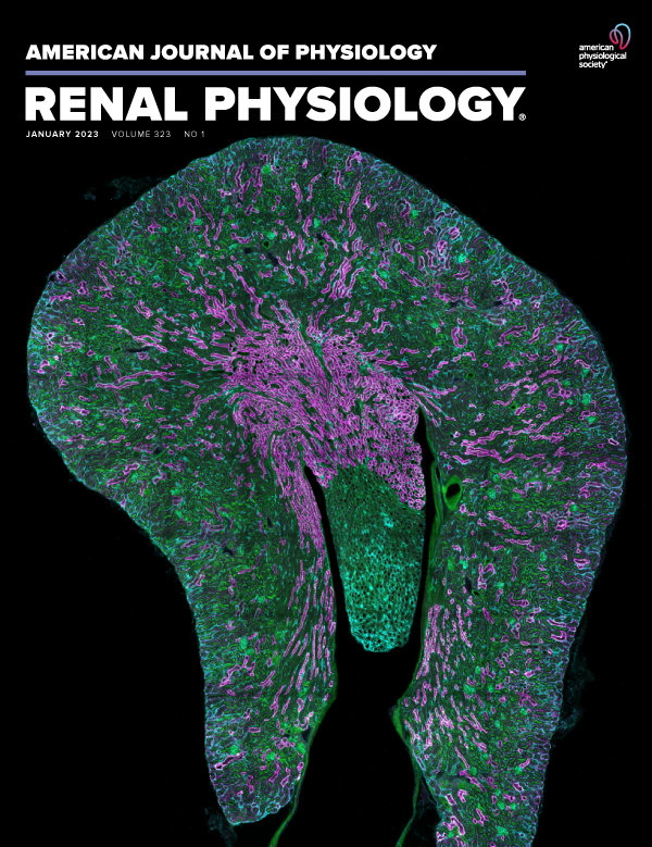 Pendrin regulation is prioritized by anion in high potassium diets