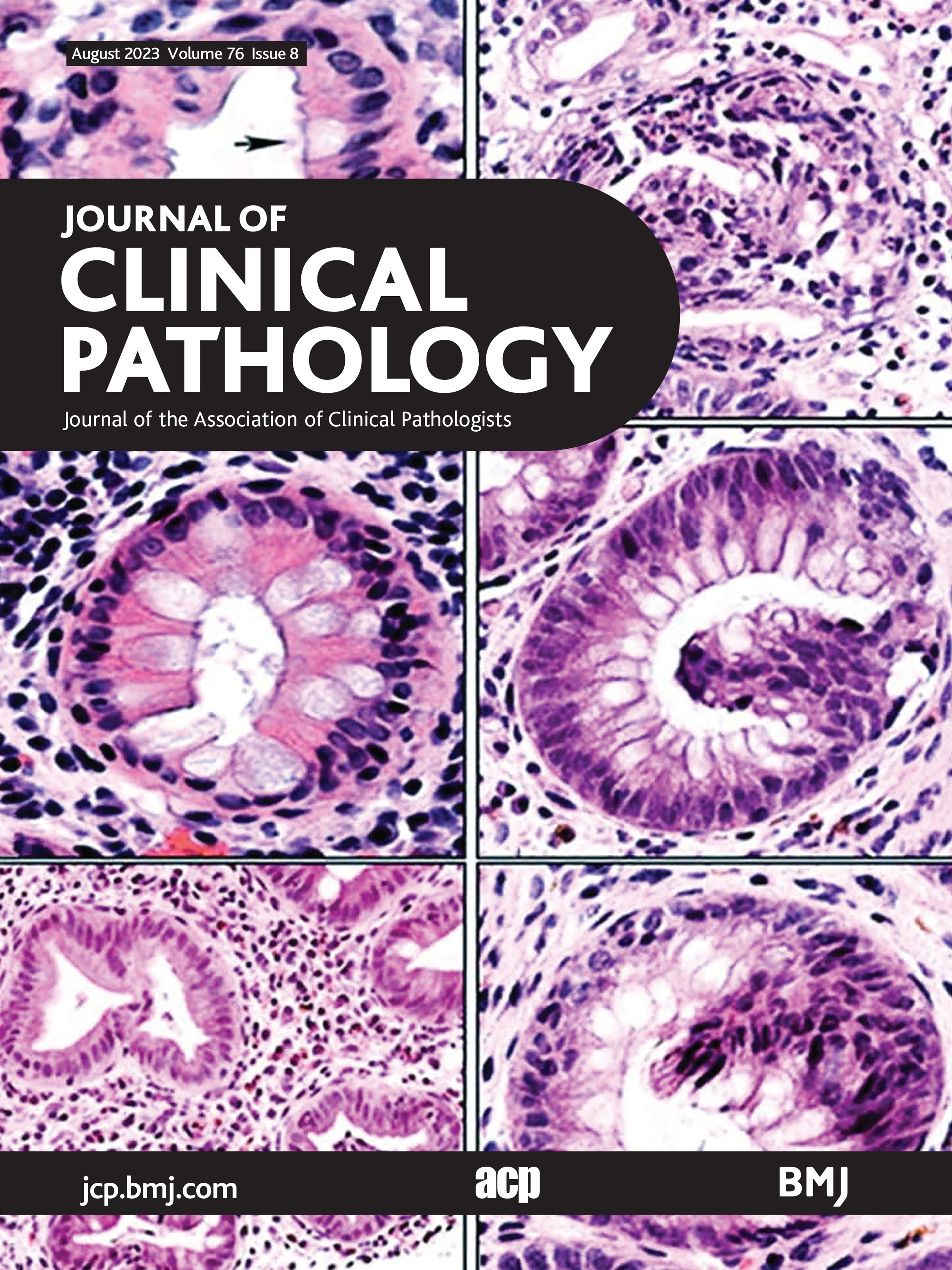 Dual resolution deep learning network with self-attention mechanism for classification and localisation of colorectal cancer in histopathological images