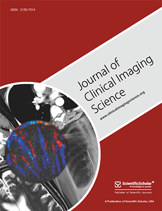 Cystic retroperitoneal dedifferentiated liposarcoma: A case report