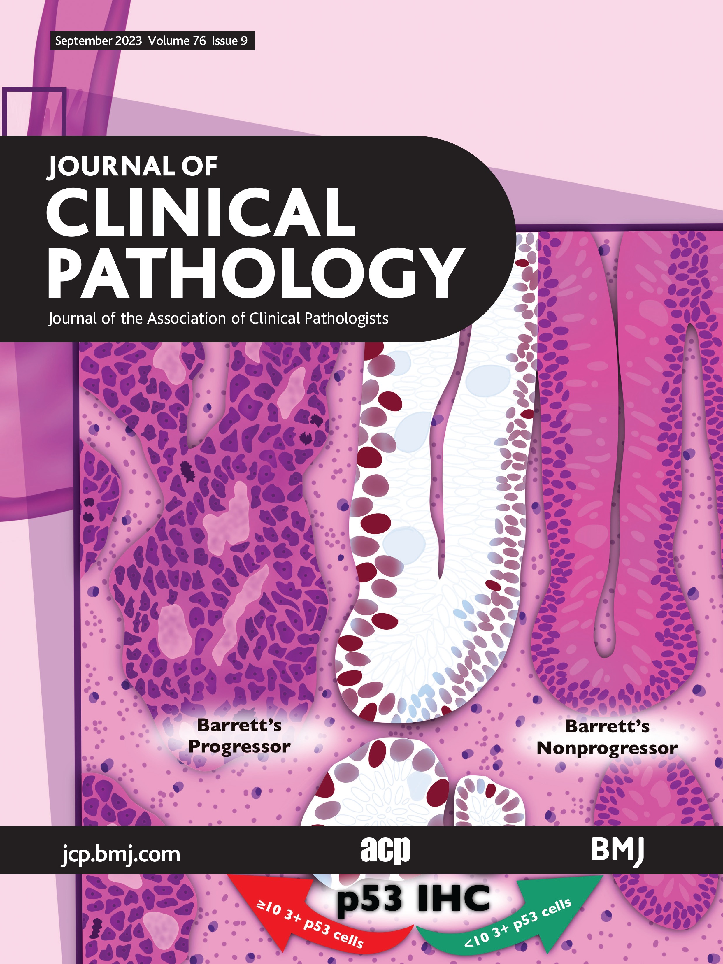 One-step genotyping of {alpha}-thalassaemia by multiplex symmetric PCR melting curve