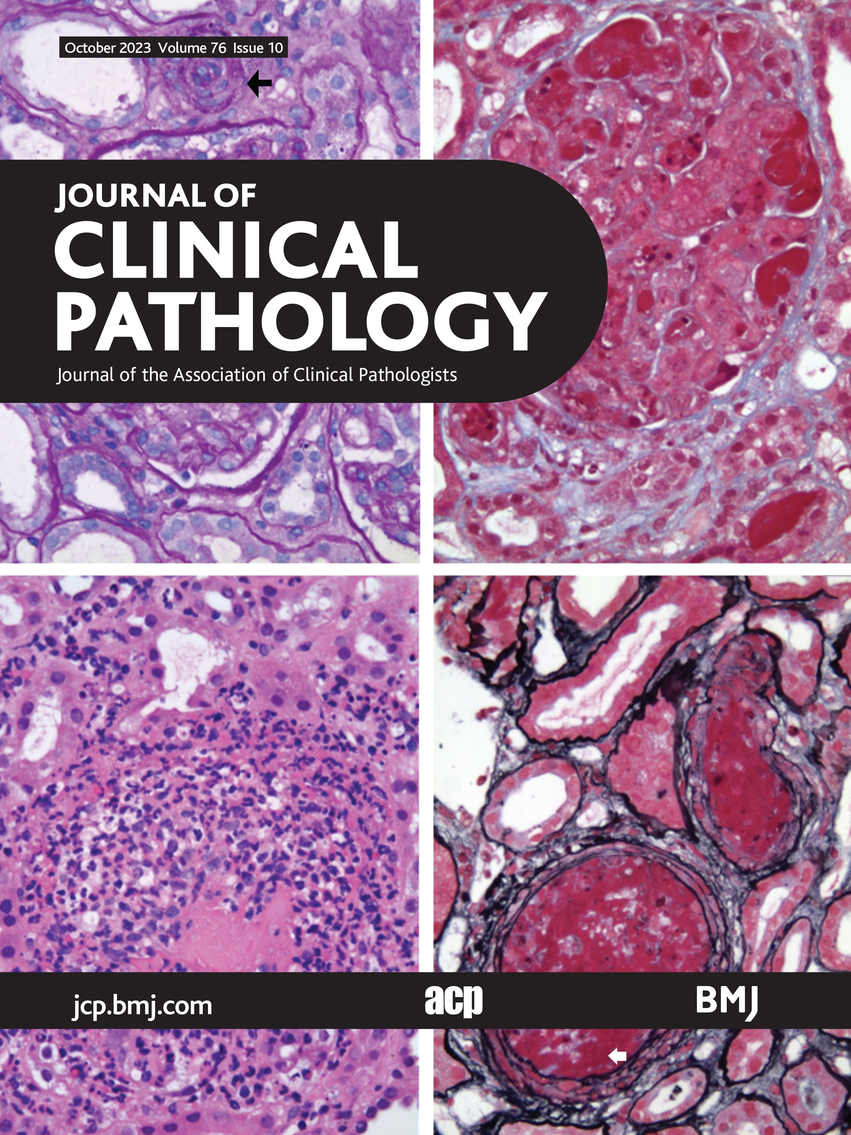 Verification and validation of the anti-PD-L1 antibody, Clone 22C3 on a laboratory-developed test