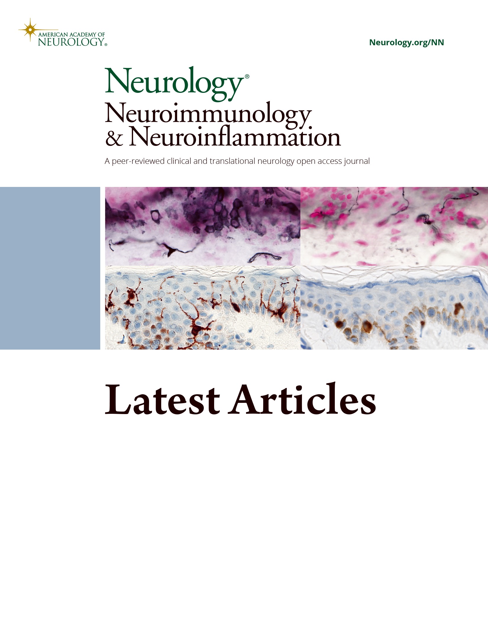 Natalizumab Treatment Induces Proinflammatory CD4 T Cells Preferentially in the Integrin {beta}7+ Compartment