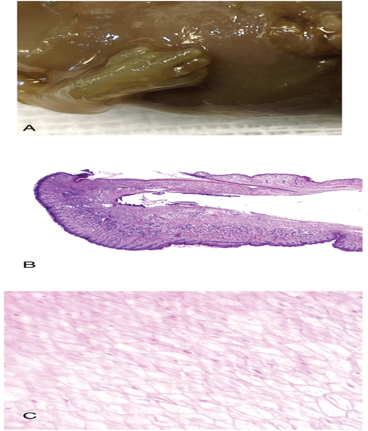 Basic Concepts in Nail Pathology