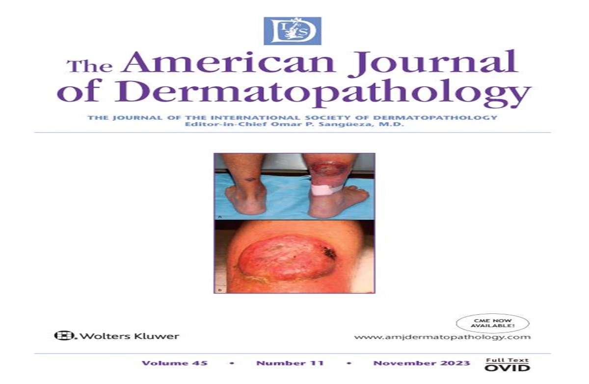 Warm, Erythematous, Edematous Plaques With Overlying Vesicles on the Thigh: Answer