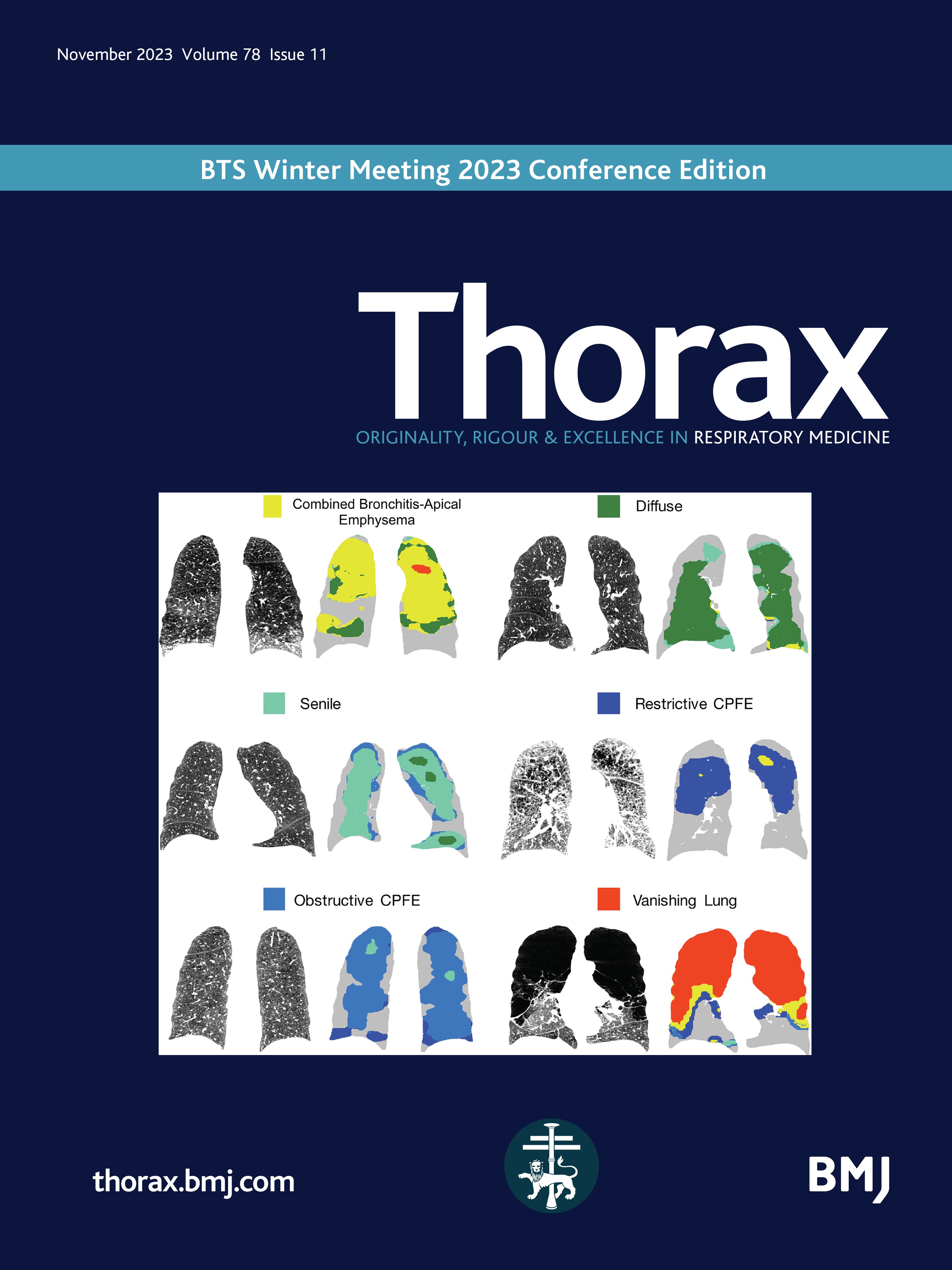 Whats new in pleural disease?