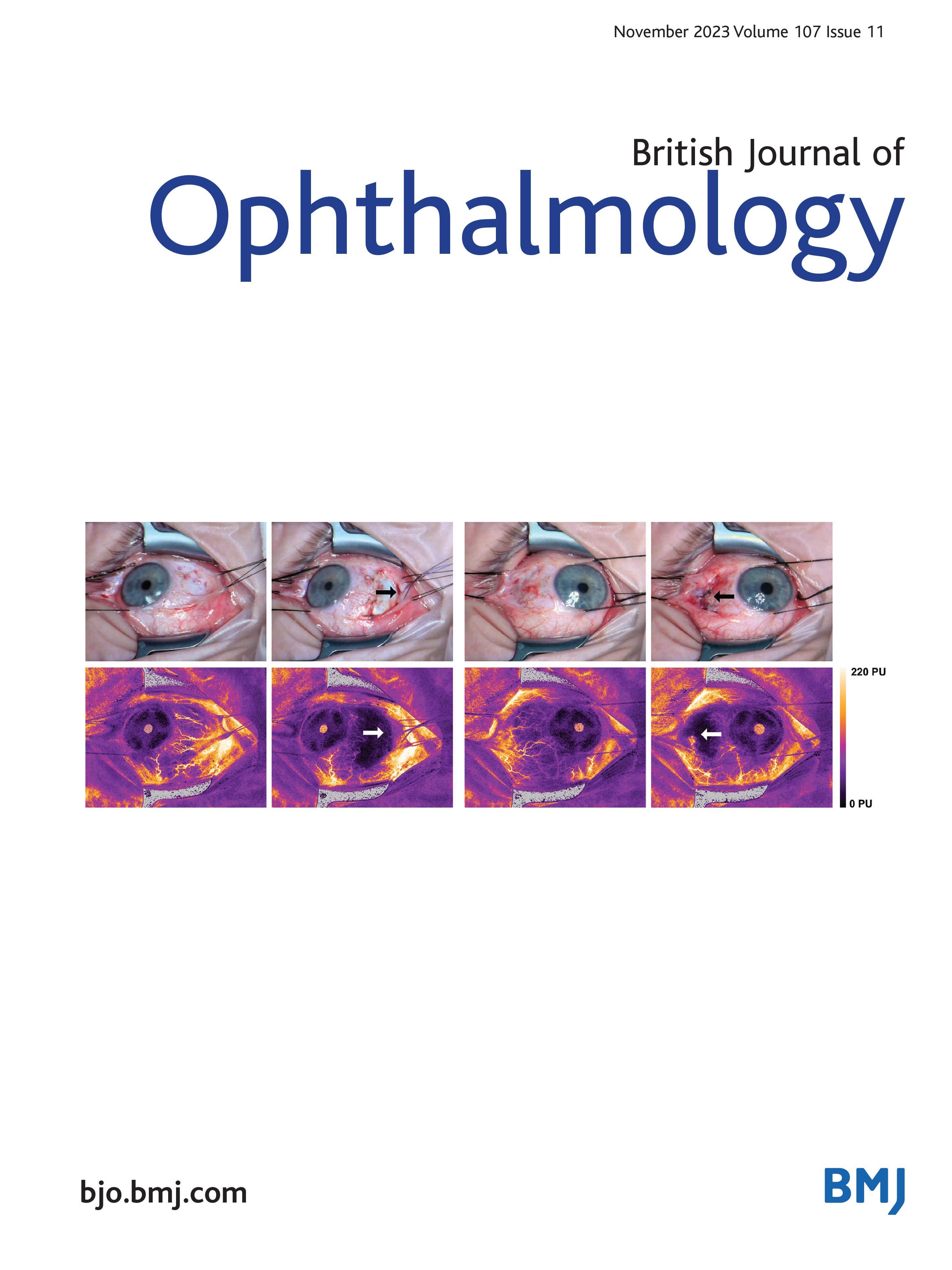 Clinical usefulness of layer-by-layer deviation maps of Spectralis OCT: comparison with Cirrus OCT