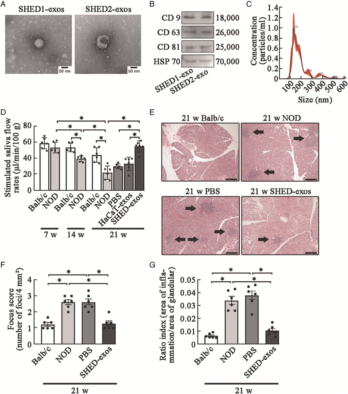 SHED-derived exosomes ameliorate hyposalivation caused by Sjögren's syndrome via Akt/GSK-3β/Slug-mediated ZO-1 expression