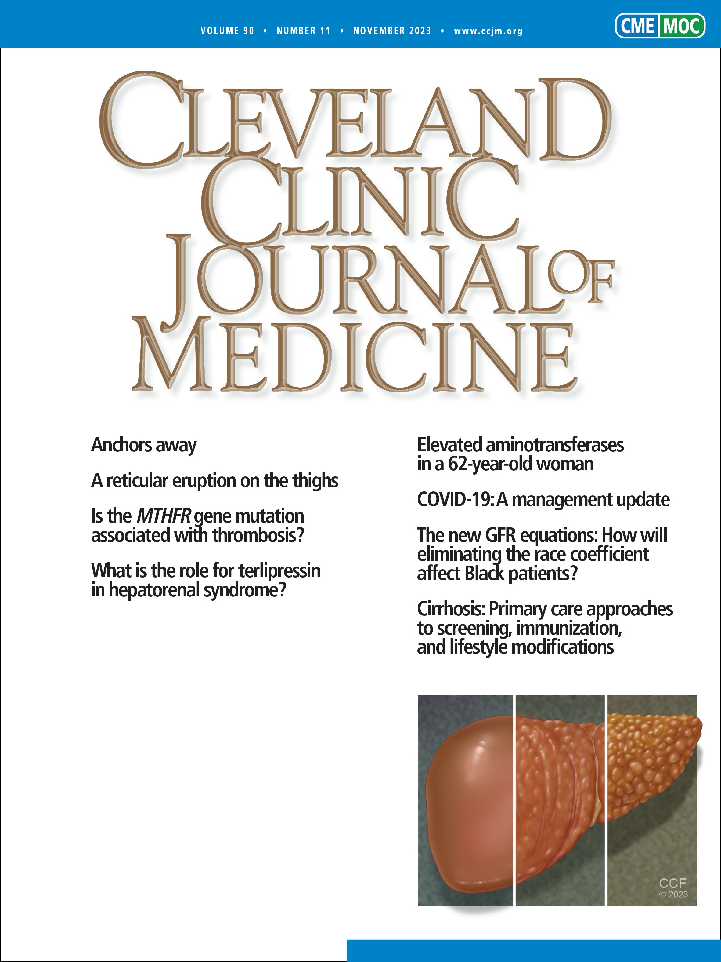 Elevated aminotransferases in a 62-year-old woman