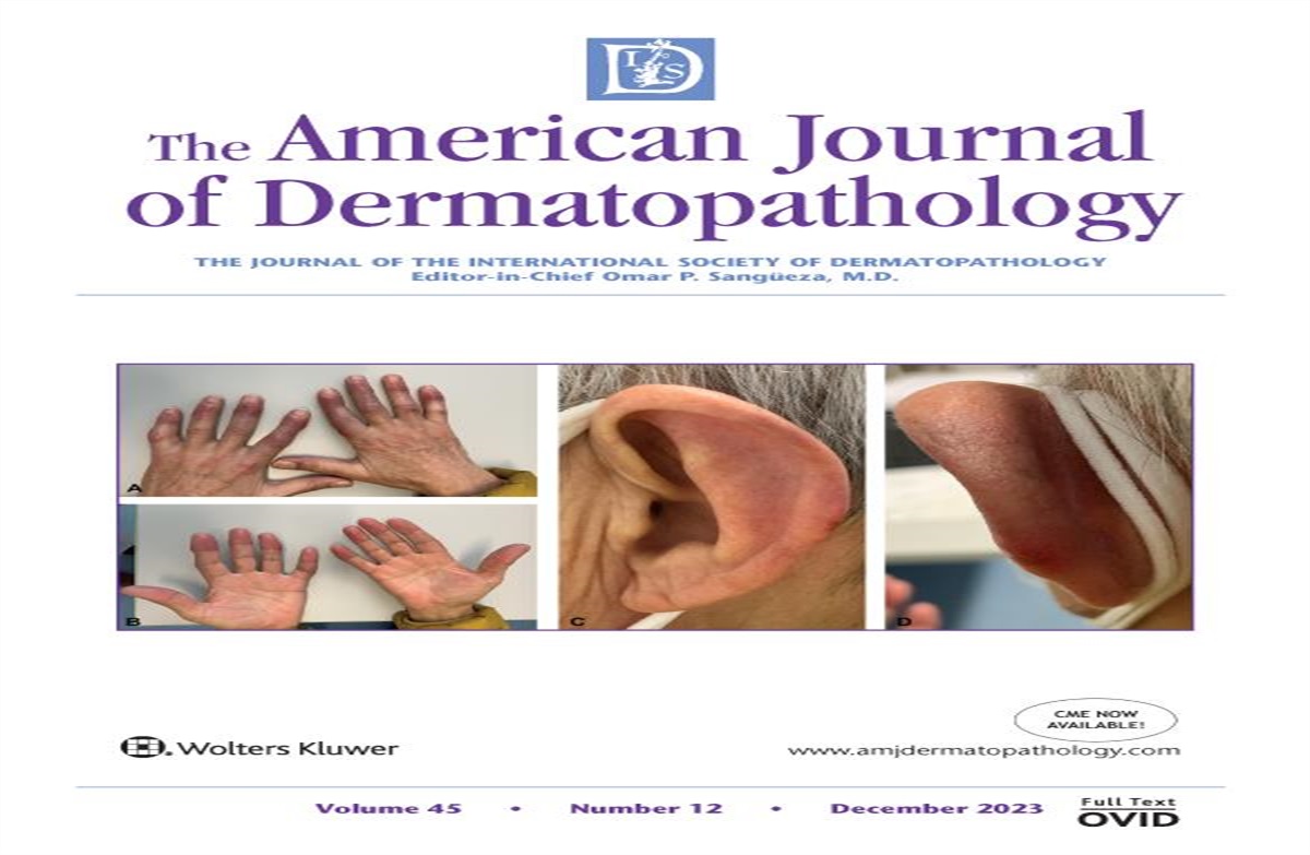 Cutaneous Involvement by Diffuse Large B-Cell Lymphoma With Dual B-Cell and T-Cell Clonality and Heavy Admixed T-Cell Infiltrate: Answer