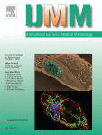 Association between hospital onset of infection and outcomes in sepsis patients – a propensity score matched cohort study based on health claims data in Germany